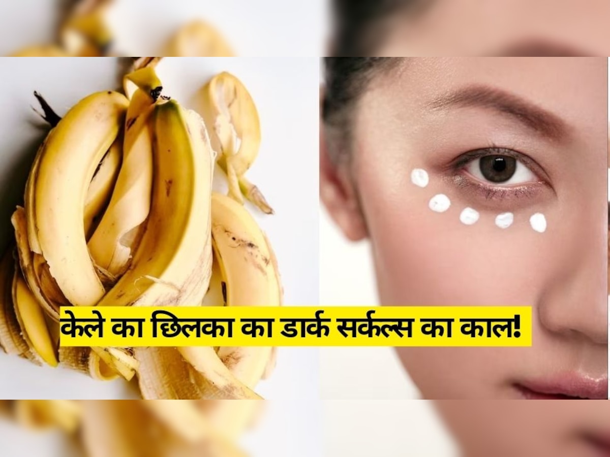 Dark Circles बिगाड़ रहे हैं चेहरे की खूबसूरती? तो केले के छिलके से ऐसे दूर होगी परेशानी