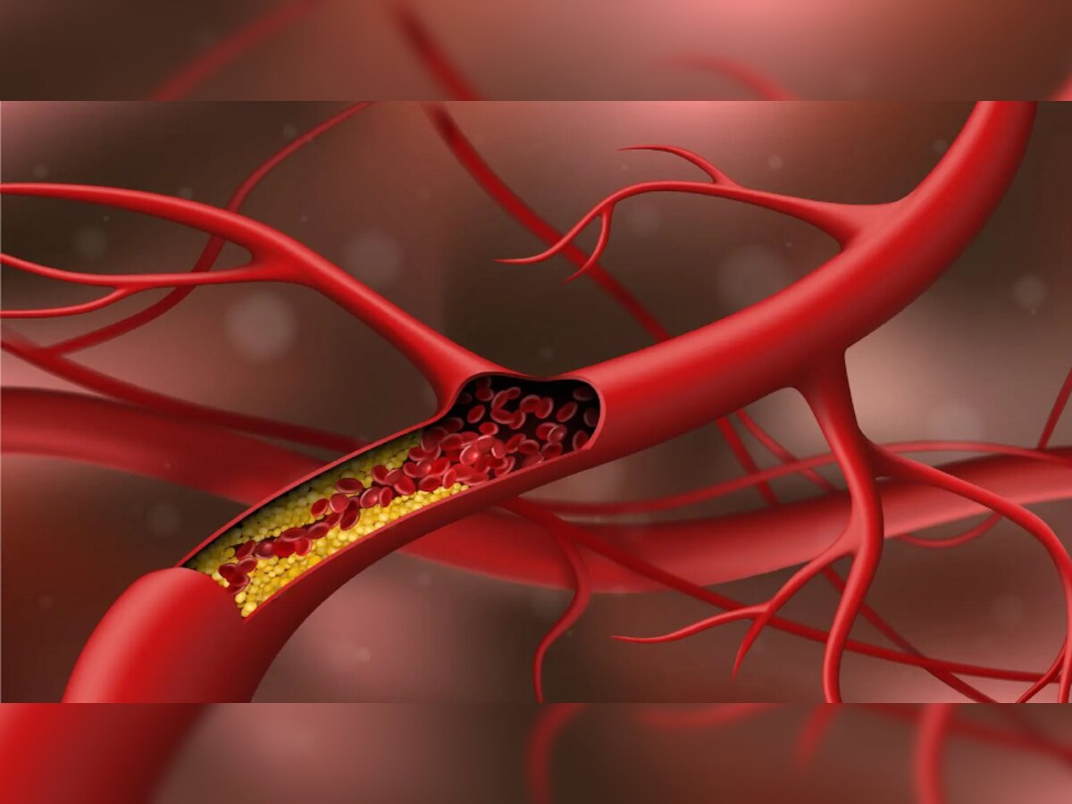 हर दिन करें इन फलों का सेवन, नहीं बढ़ेगा Bad Cholesterol! हार्ट अटैक का भी खतरा रहेगा कम 