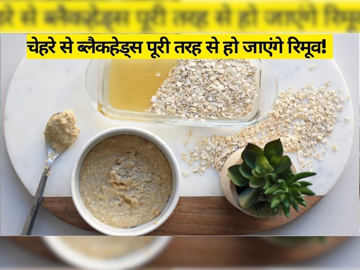 Black Heads Treatment: दही में मिलाकर लगाएं ये एक चीज, चेहरे से ब्लैकहेड्स पूरी तरह से हो जाएंगे रिमूव