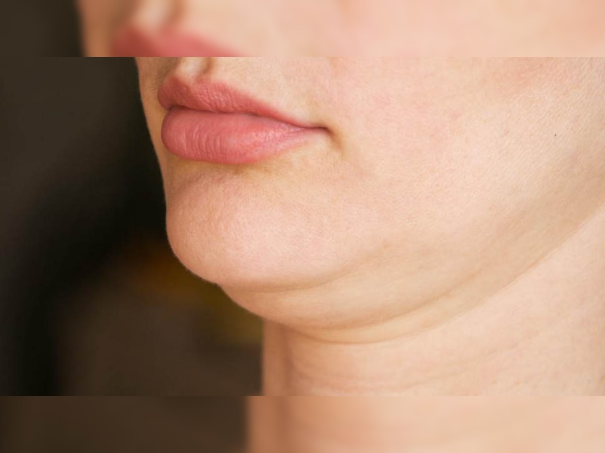 Double Chin: क्यों होती है डबल चिन? इन तरीकों से करें इसे जड़ से खत्म