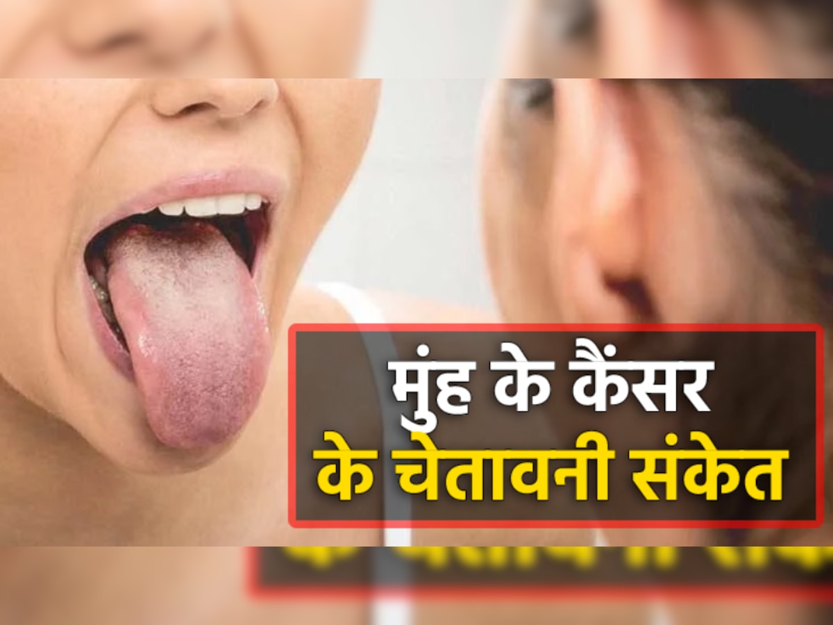 Oral Cancer Symptoms: भारत में सबसे आम कैंसर में से एक है मुंह का कैंसर, इन लक्षणों को ना करें नजरअंदाज; वरना बाद में पड़ेगा पछताना!
