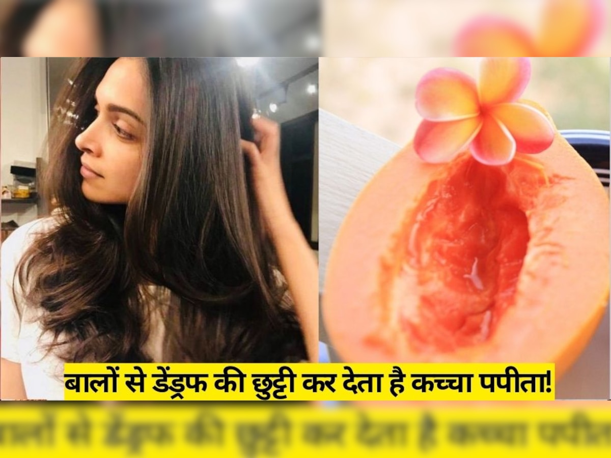 Dandruff Free Hair: बालों में ऐसे इस्तेमाल करें कच्चा पपीता, बालों से डैंड्रफ हमेशा के लिए हो जाएगा दूर