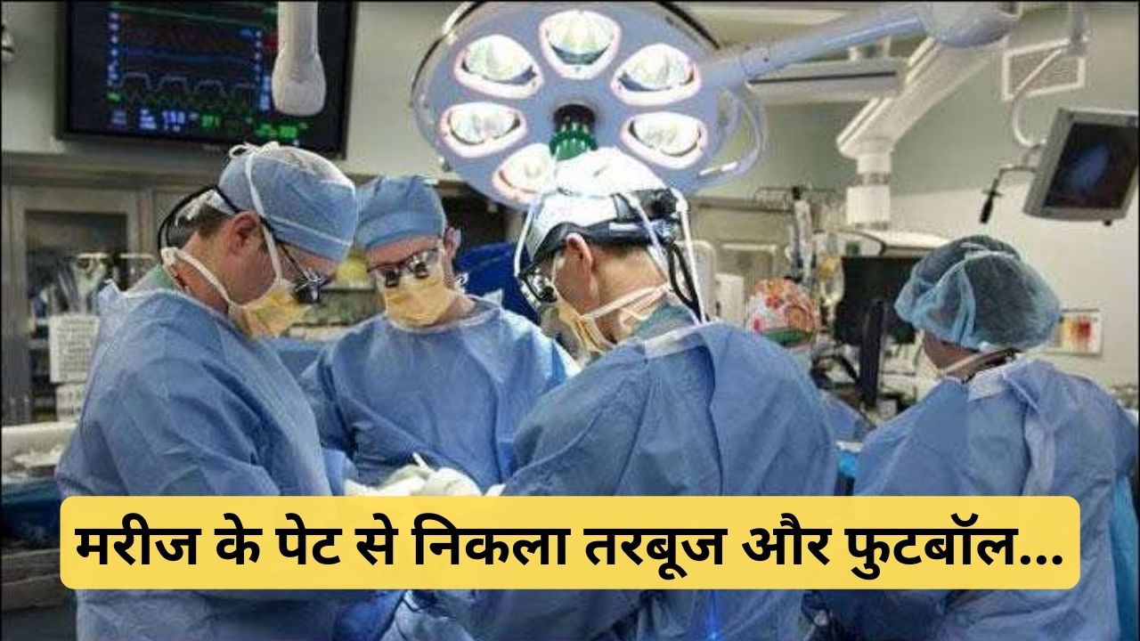 Delhi के डॉक्टरों ने किया हैरतअंगेज कारनामा, आदमी के पेट से निकाले तरबूज और फुटबॉल साइज के ट्यूमर