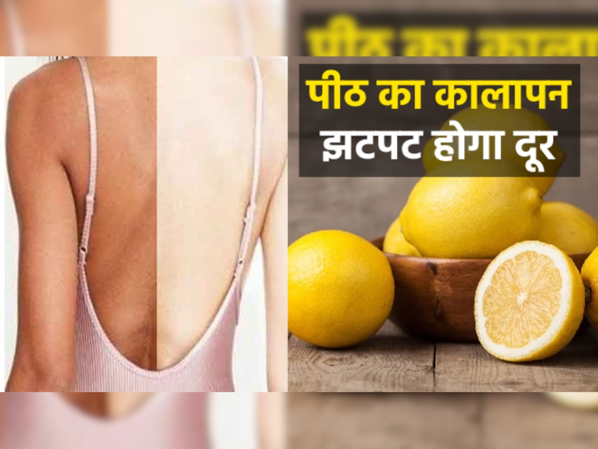 Lemon for black skin: पीठ का कालापन झटपट दूर करेगा नींबू, इन 4 तरीकों से करें इस्तेमाल