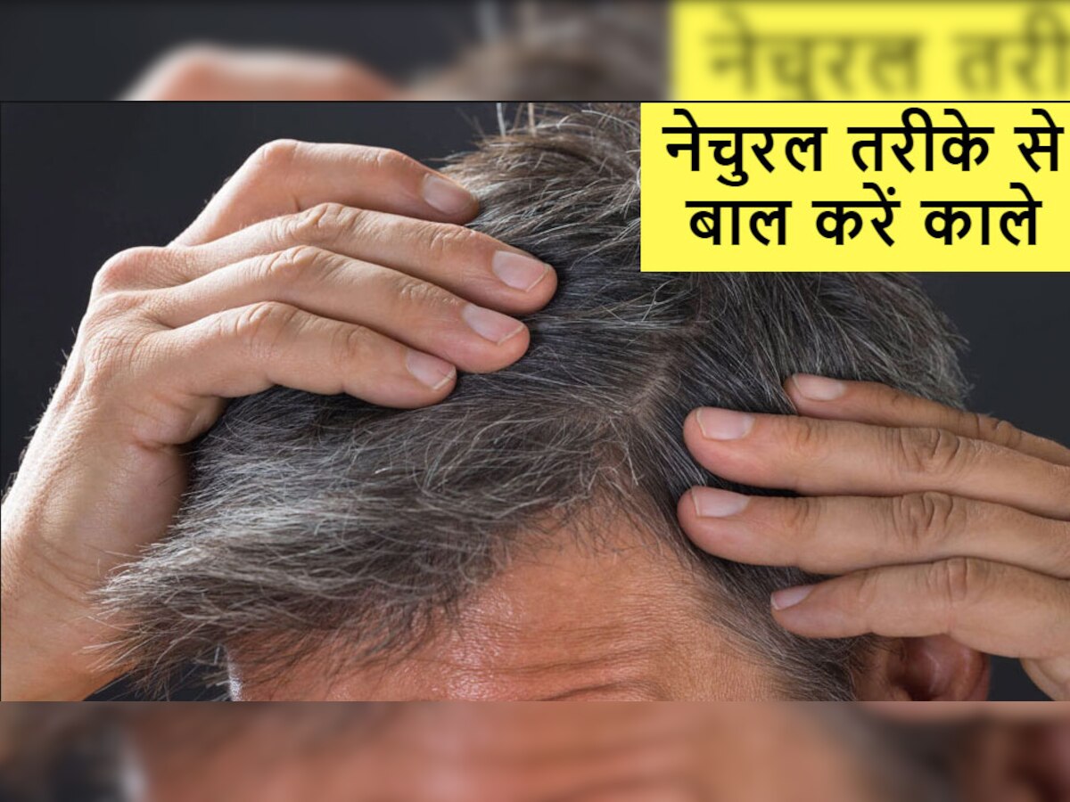 White Hair: शादी से पहले सफेद बाल उगने की वजह से बच्चे कहने लगे 'अंकल', जानिए वापस कैसे पाएं कालापन