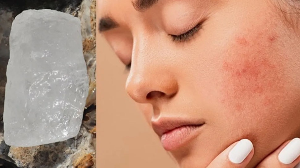 Face Cleaning Tips: चेहरे पर झाइयां आने और अनचाहे बालों से परेशान? कर लें गुलाब जल और फिटकरी का ये आसान उपाय