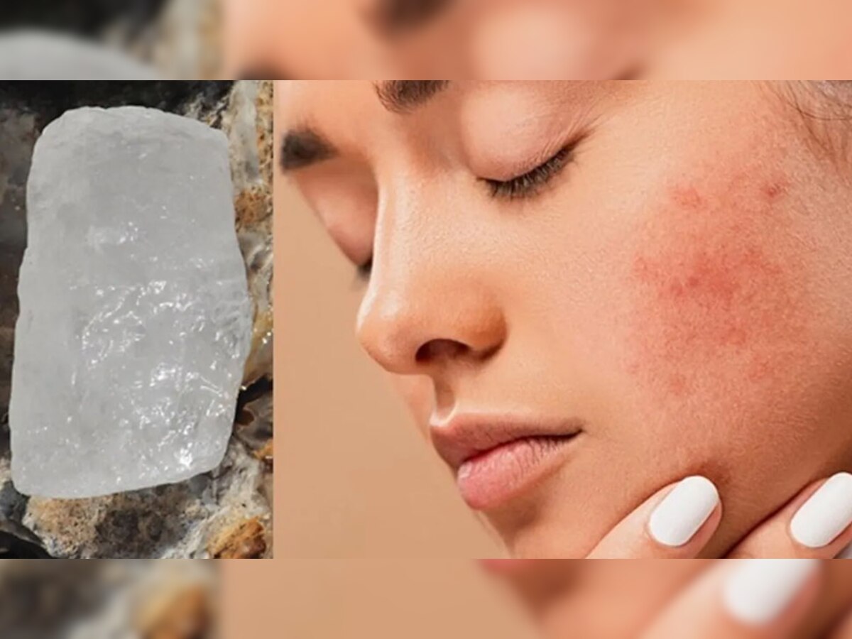 Face cleaning tips Gulabjal aur Fitkari ke Labh Alum and Rose Water