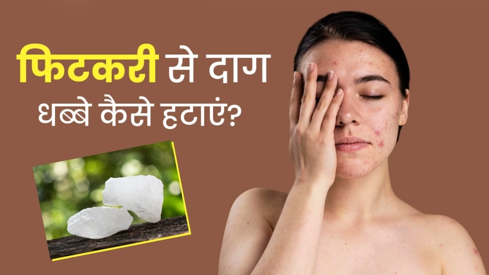 Alum Face Mask To Get Rid Of Dark Spots Skin Care Tips Hindi News