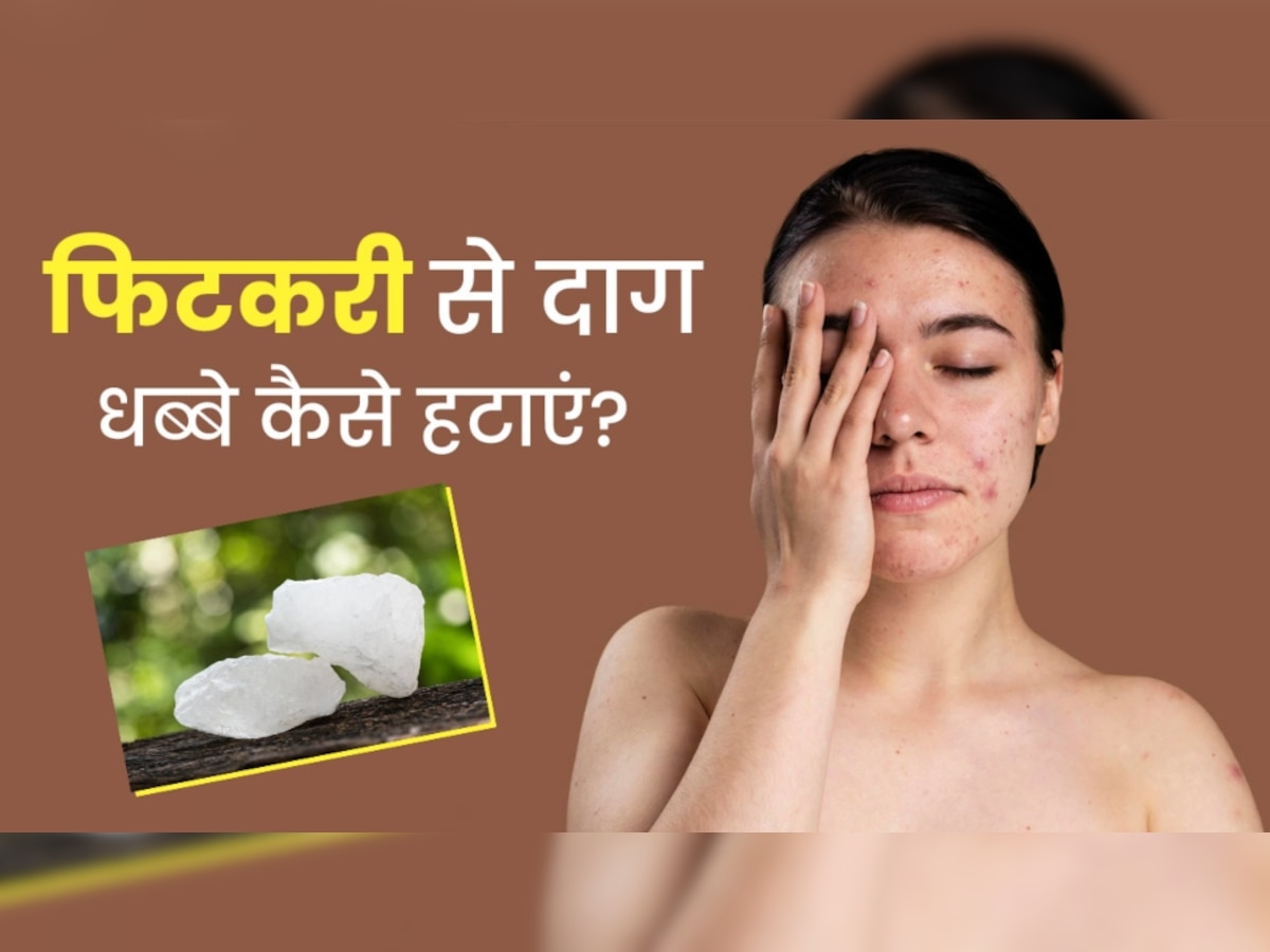 Alum Face Mask To Get Rid Of Dark Spots Skin Care Tips Hindi News