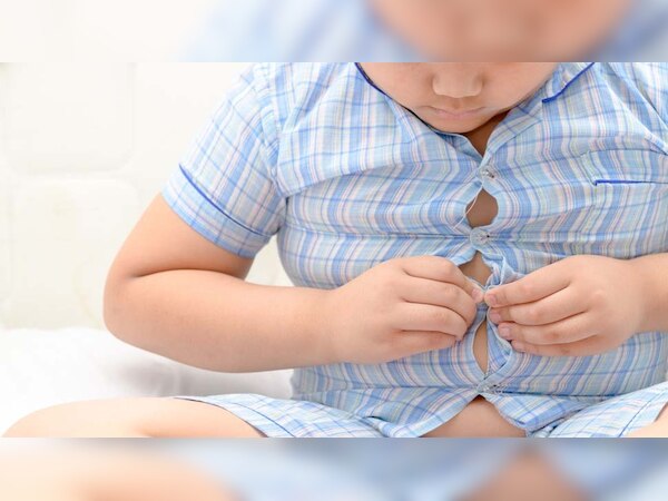 World Obesity Day: देश में तेजी से बढ़ रही है मोटे बच्चों की संख्या; 2035 तक हो जाएगा बुरा हाल ! 
