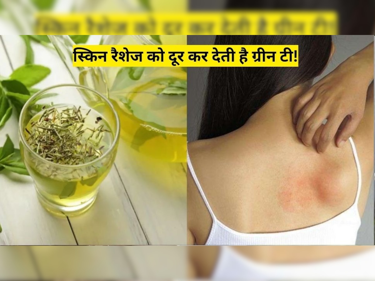 Beauty Tips: स्किन रैशेज की इरिटेशन को दूर कर देती है ग्रीन टी, ऐसे आजमाकर पाएं निजात