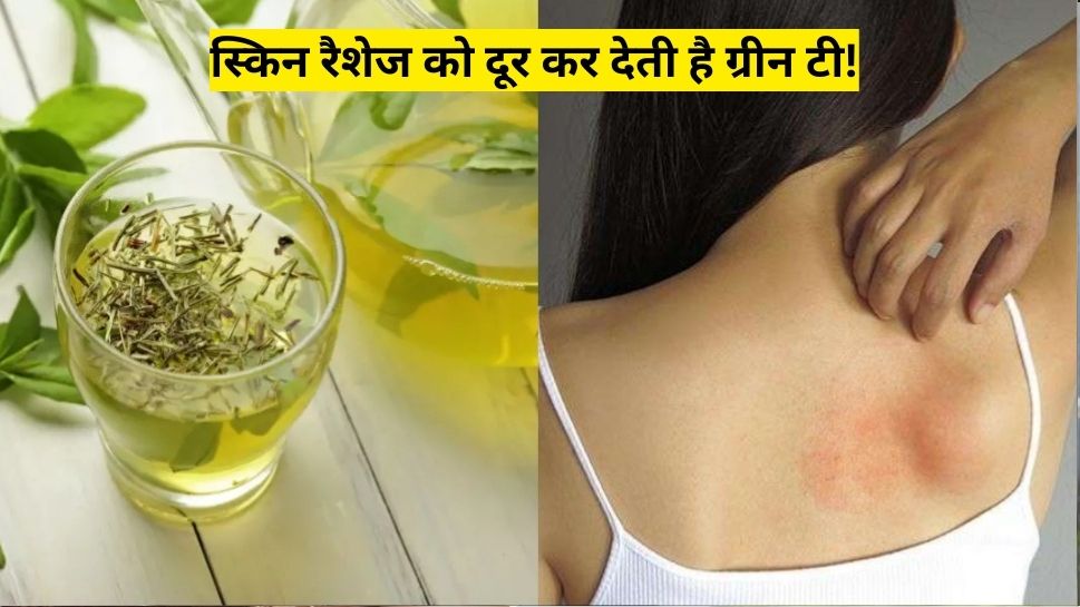 How To Get Rid Of Skin Rashes Problem Use Green Tea | Hindi News, स्किन ...