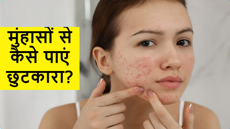 Anti Pimples Drinks: पिंपल्स बिगाड़ रहे हैं चेहरे की खूबसूरती? तो रोजाना पिएं ये 3 जादुई ड्रिक्स, दूर होंगे दाग-धब्बे