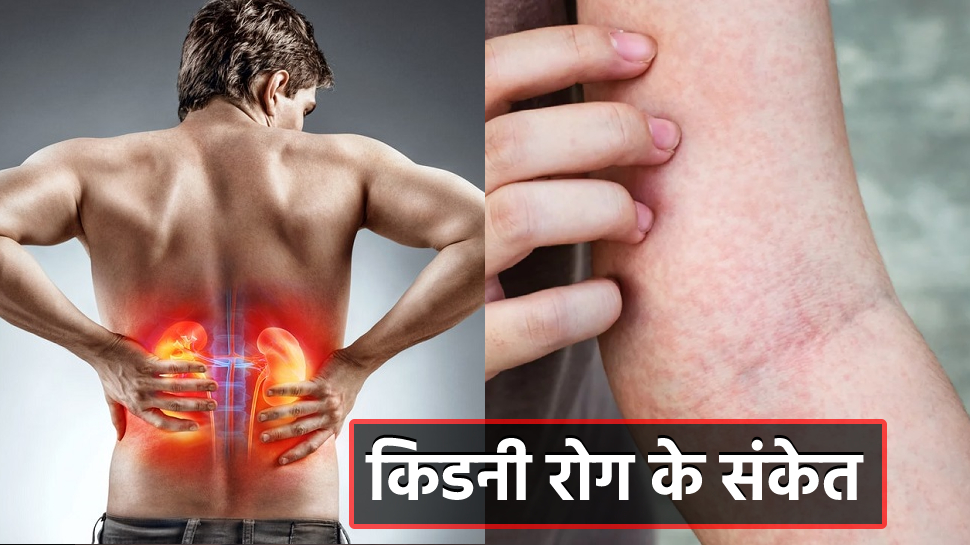 Kidney Disease: Itchy skin and unusual rashes gives warning signs of ...