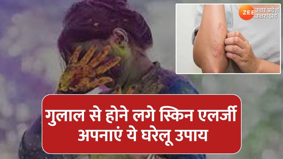 playing Holi If your face gets allergic folloe These home remedies will ...
