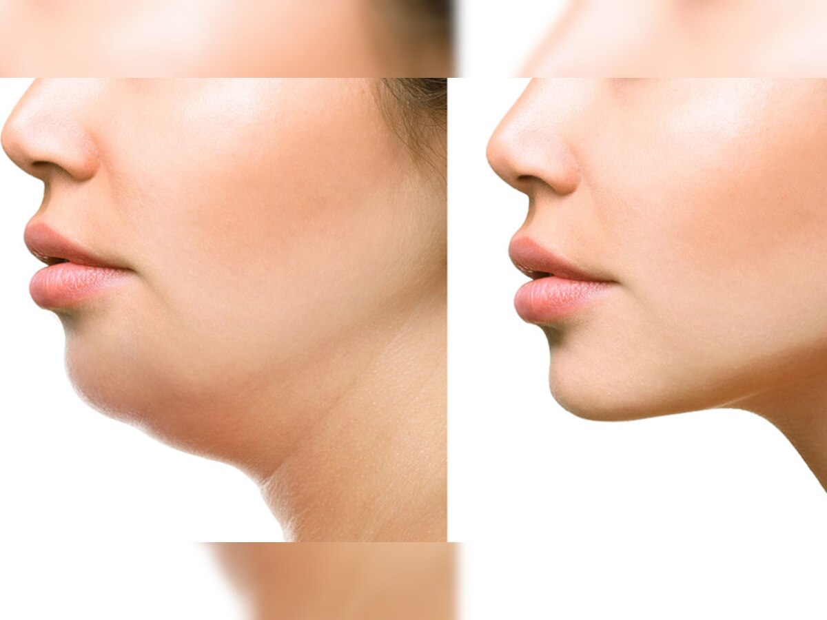 face fat loss: गोल चेहरे को कम करने के लिए घर बैठे करें ये काम, दिखेंगी खूबसूरत