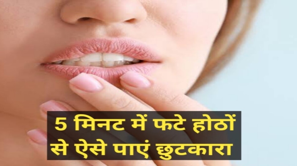 How to Treat Dry Lips Use Kheera Lip Mask Lips Care Tips Hindi News, फटे होंठों को मुलायम बना