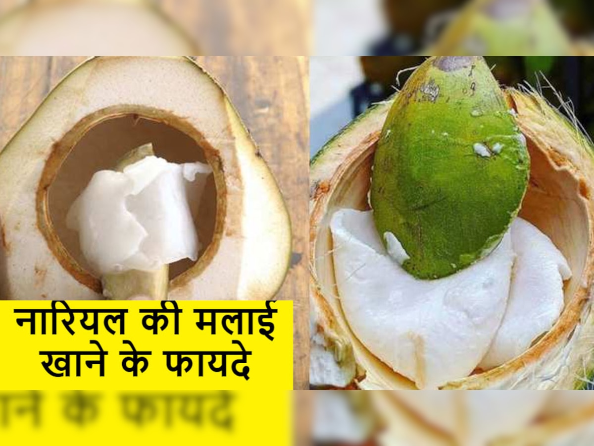 Coconut Cream: नारियल पानी पीने के बाद न फेंके इसकी मलाई, फायदे गिन नहीं पाएंगे आप