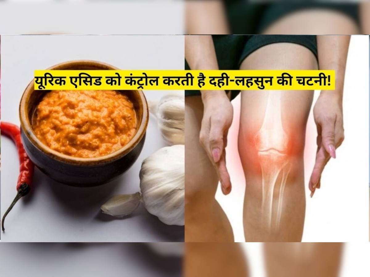 Food For Uric Acid: यूरिक एसिड को कंट्रोल करती है दही-लहसुन की चटनी, खाने में भी होती है खूब चटपटी