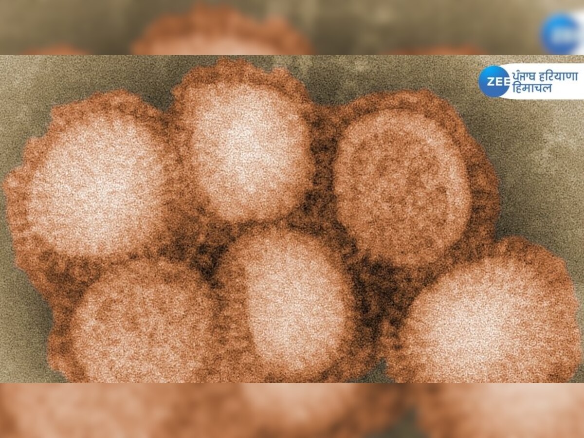 ਜਾਨਲੇਵਾ ਹੋਇਆ H3N2 Influenza virus... 2 ਮਰੀਜਾਂ ਦੀ ਹੋਈ ਮੌਤ, ਜਾਣੋ ਕਿਹੜੇ ਸੂਬਿਆਂ 'ਚ ਹੋਈਆਂ ਮੌਤਾਂ 