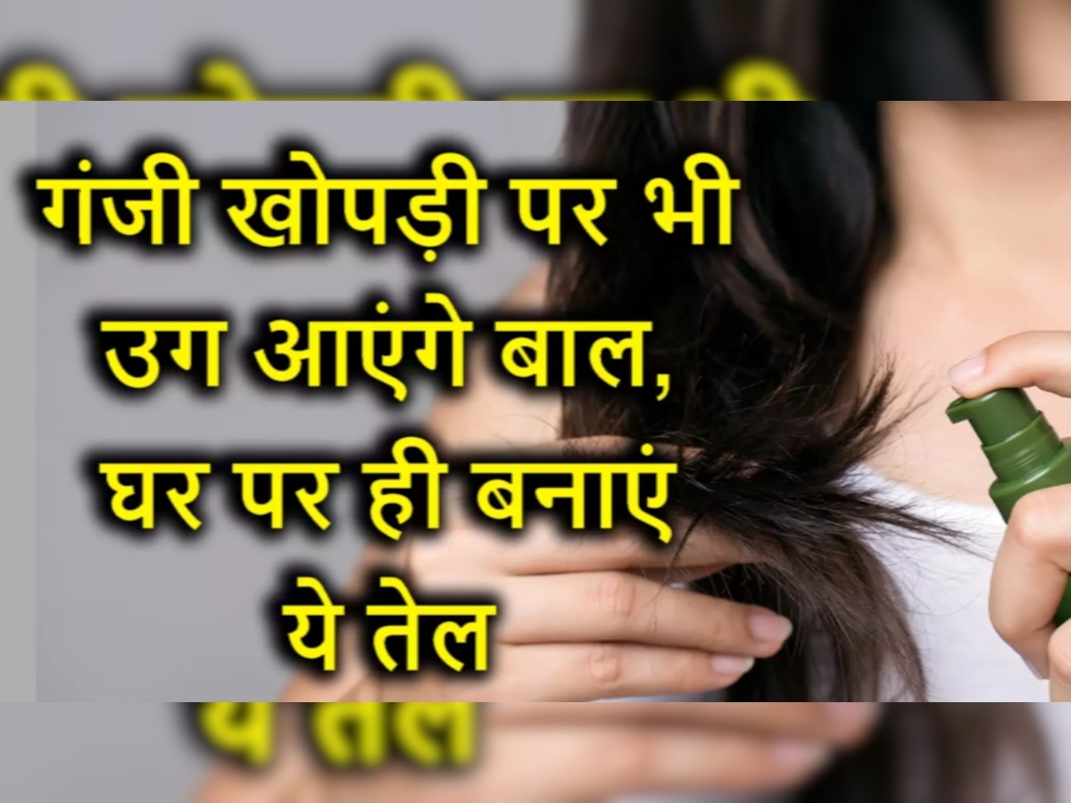 Hair Growth Oil: पतले होते जा रहे हैं बाल झड़-झड़कर? घर पर बनाएं ये हेयर ग्रोथ ऑयल, बाल बनेंगे ब्यूटीफुल