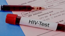 इस मेले में आने वाली डांसरों का कराया गया HIV टेस्ट, प्रशासन की मंशा पर उठे सवाल