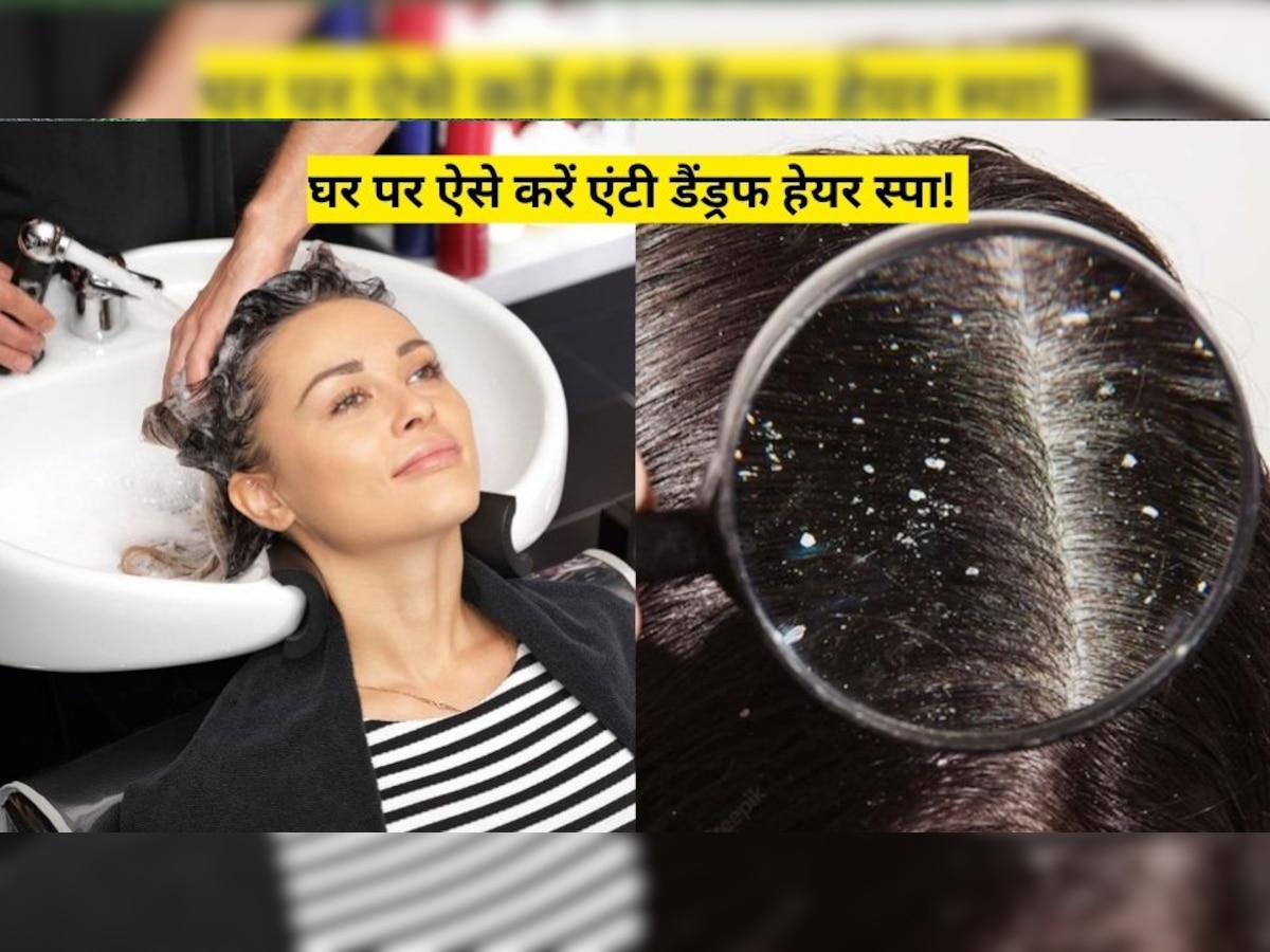 Dandruff Solution: बालों से झड़ते डैंड्रफ ने कर दिया है जीना दुश्वार? तो घर की चीजों से करें एंटी डैंड्रफ हेयर स्पा