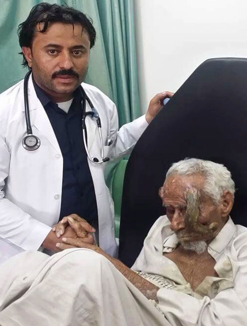 Worlds oldest man with two horn like growths on head dies yemen ali