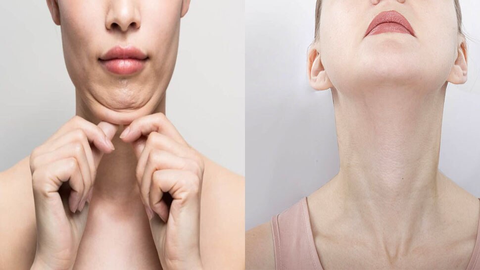 how-to-reduce-face-and-know-more-about-these-amazing-tips-for-face-fat