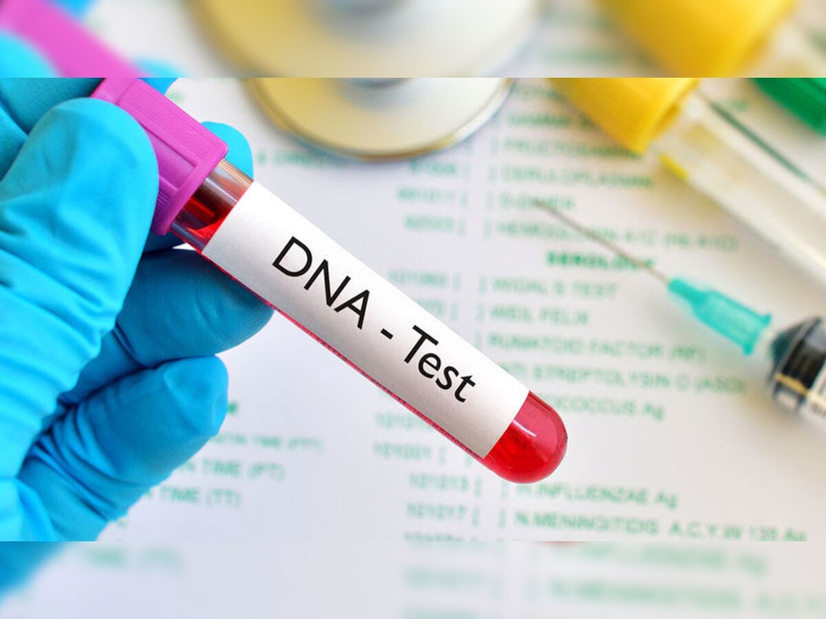 DNA Test: बेटे ने अपना और पिता का करवाया डीएनए टेस्ट, सामने आई मां की ऐसी हकीकत; टूटकर बिखर गया पूरा परिवार 