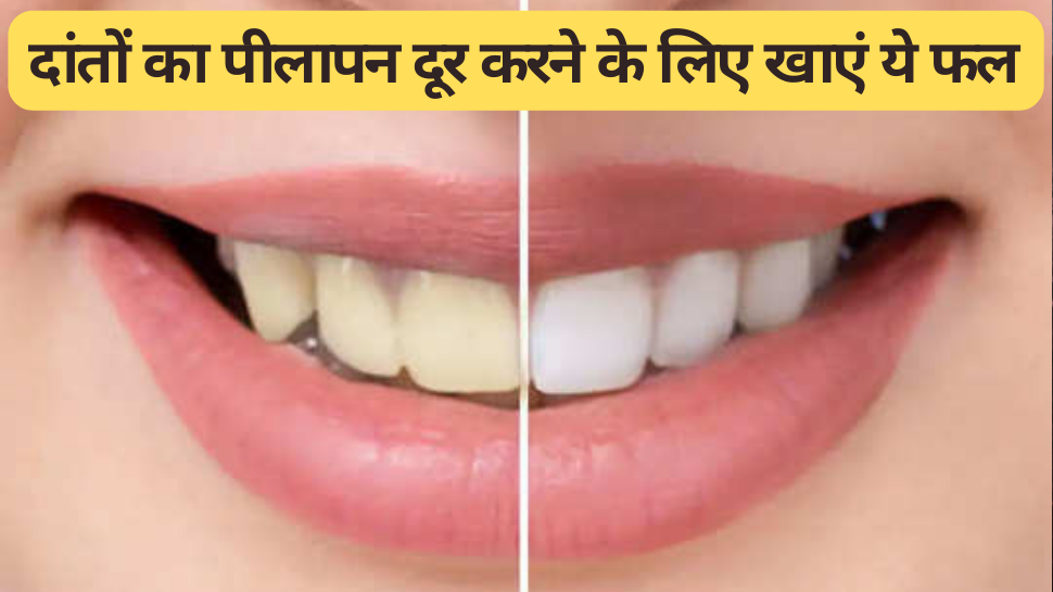 Oral Health: दांतों का पीलापन दूर करने के लिए इन फलों को करें डाइट में शामिल, मोती जैसे चमक उठेंगे दांत
