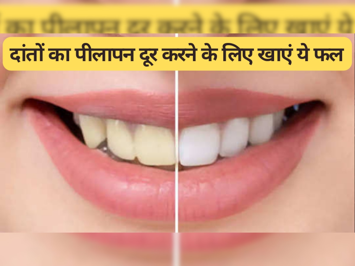Oral Health: दांतों का पीलापन दूर करने के लिए इन फलों को करें डाइट में शामिल, मोती जैसे चमक उठेंगे दांत