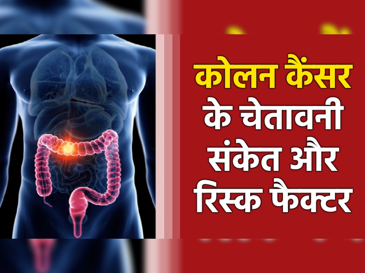 Colon Cancer: युवाओं में तेजी से बढ़ रहा कोलन कैंसर; जानिए चेतावनी संकेत और रिस्क फैक्टर