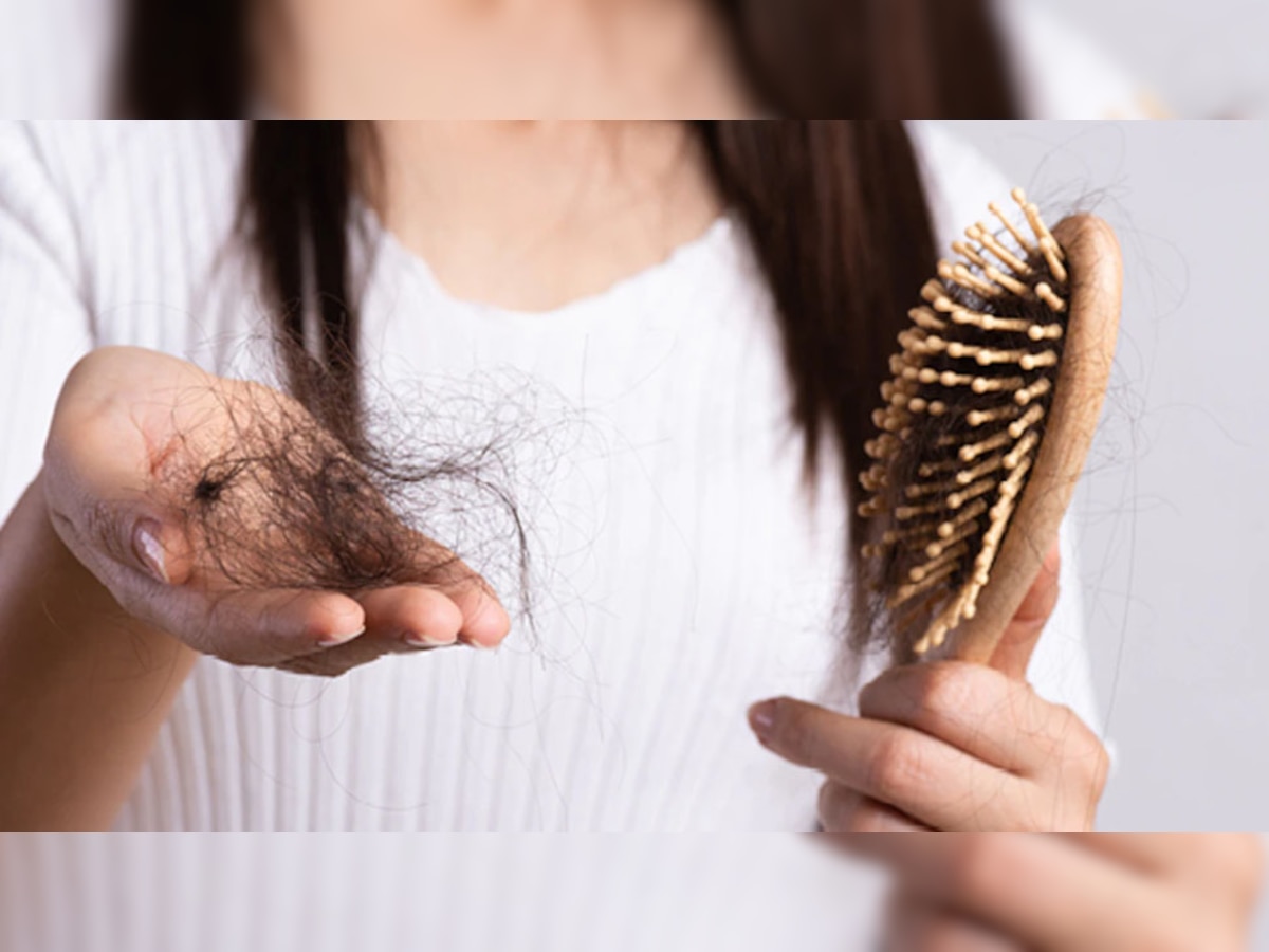 Hair Care Tips: कंघी करते ही हाथों में आ जाते बालों के गुच्छे? भूल से भी न करें ये 5 गलतियां, पहले की तरह लहलहा उठेंगे बाल 
