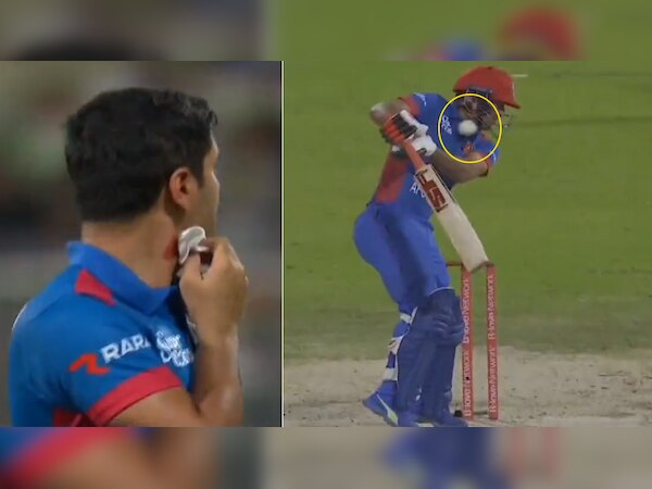 PAK गेंदबाज ने AFG बल्लेबाज पर उतारी 2 मैचों की हार की खीज? मारा ऐसा बाउंसर कि निकल गया खून