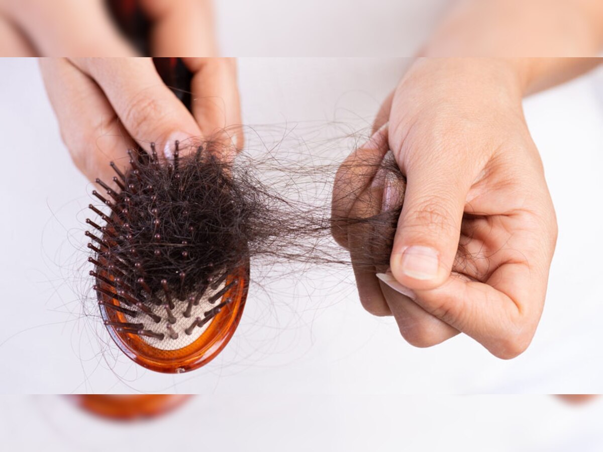 Hair Care Tips: बालों को झड़ने से बचाना चाहते हैं? आज से अपनाने शुरू कर दें ये 5 उपाय, पहले की तरह हो जाएंगे घने