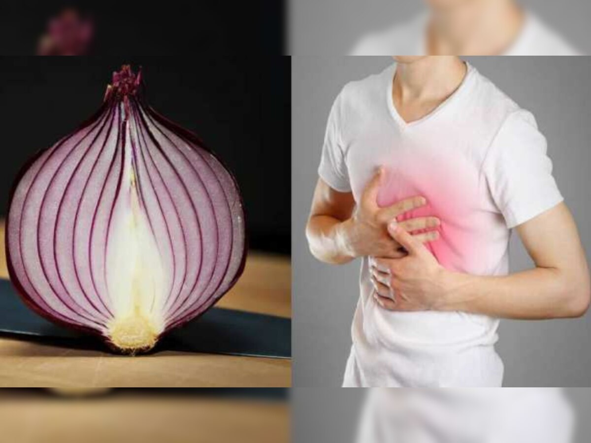 Raw Onion Benefits: रोजाना कच्चे प्याज खाने से होते हैं गजब के फायदे, इन बीमारियों से मिल सकती है राहत