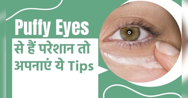 how-to-make-puffy-eyes-solution-aloe-vera-for-skin-hindi-news