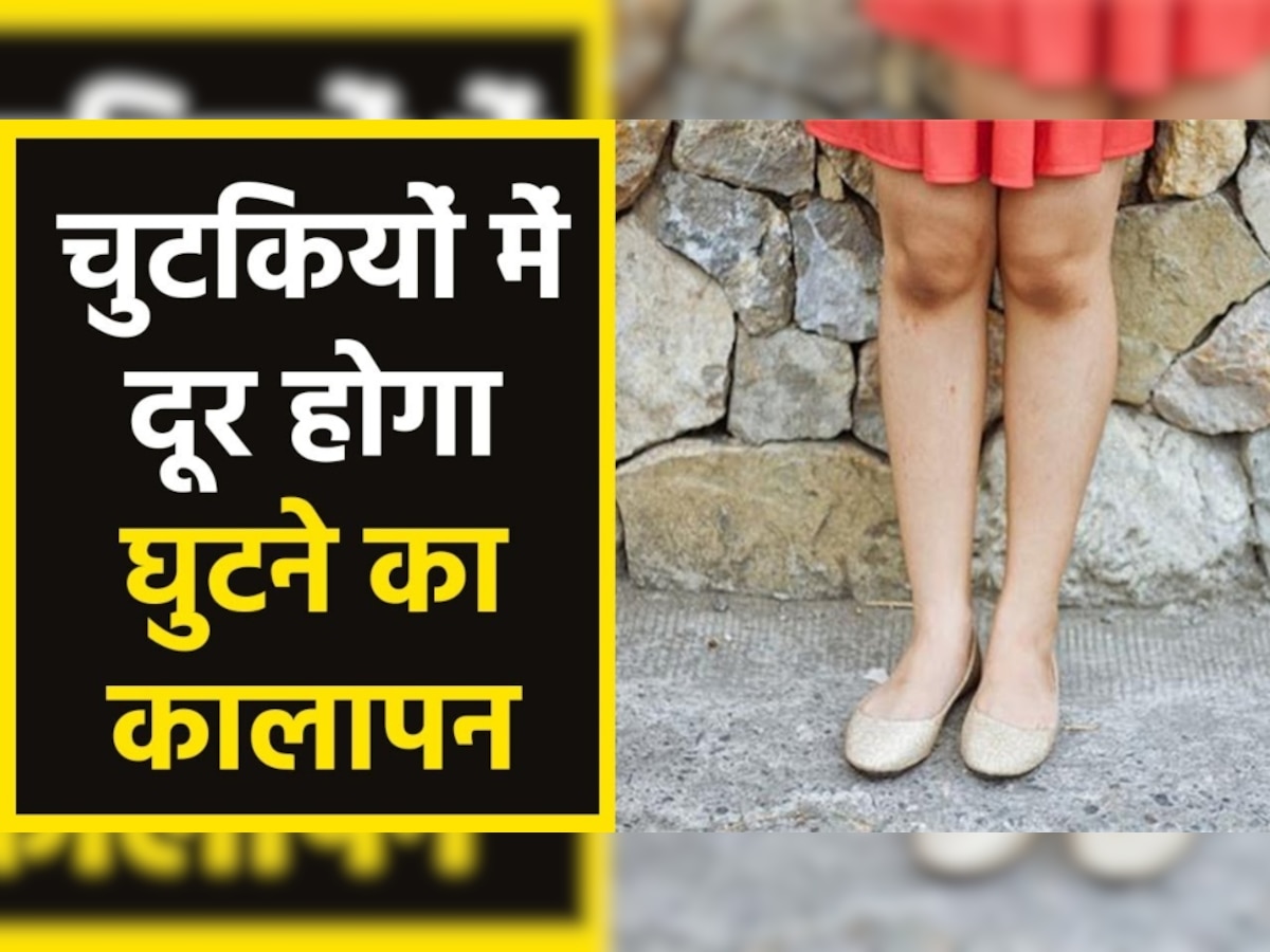 Knee Care: घर पर मौजूद इस 1 चीज से साफ हो जाएंगे काले पड़े घुटने, बस ऐसे आजमाकर देखें