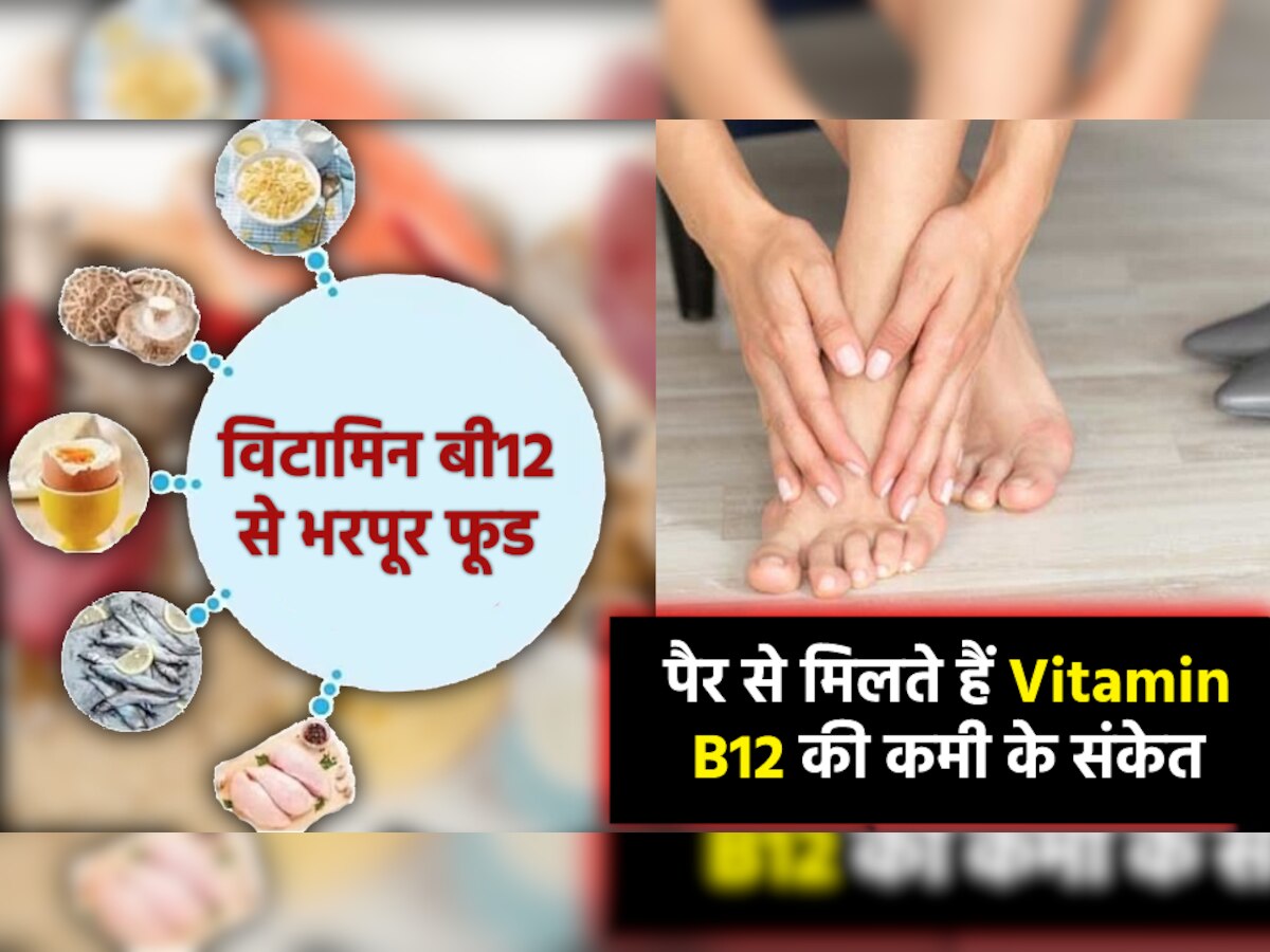 Vitamin B12 Deficiency: हाथ-पैर दिखने लगे ऐसे तो समझ जाएं कि शरीर में है विटामिन बी12 की कमी, तुरंत खाना शुरू करें 5 चीजें