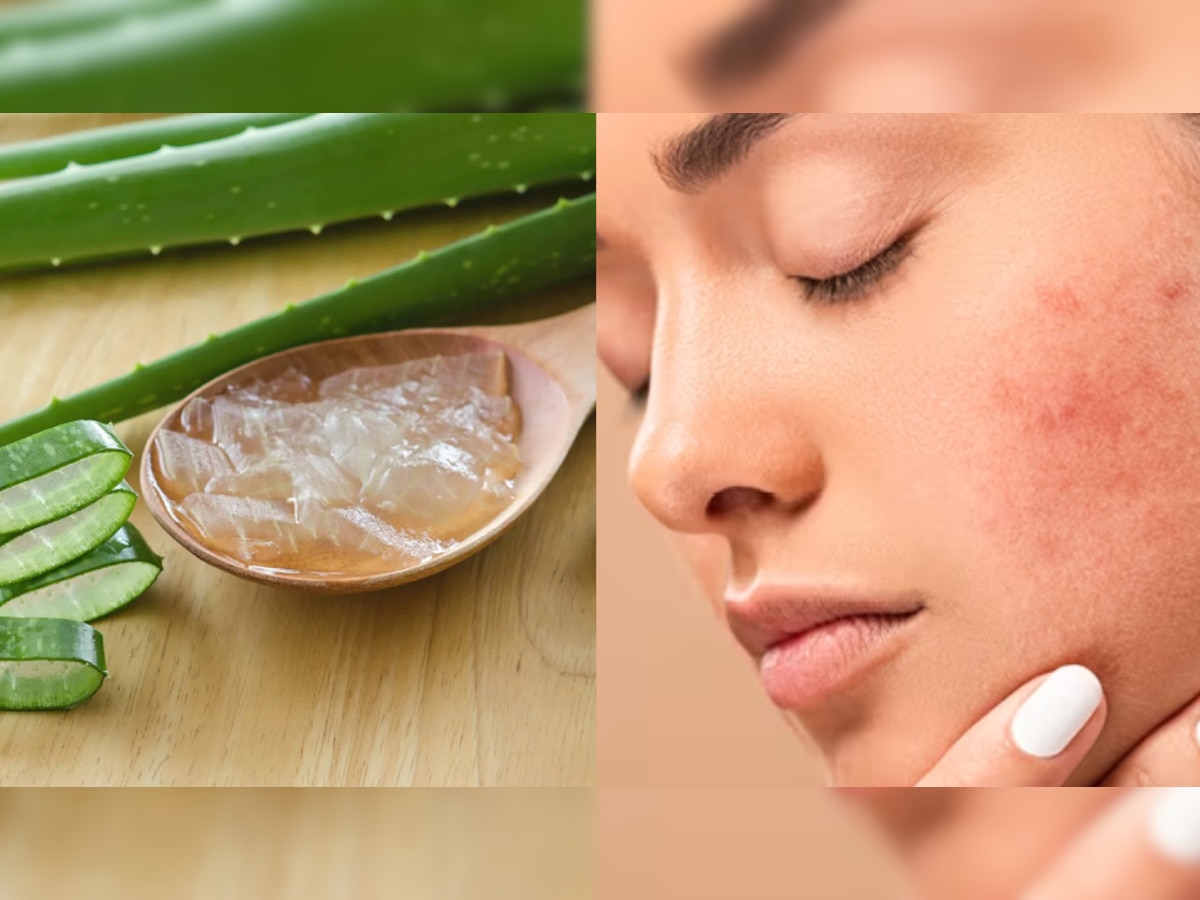 Aloevera Benefits: चेहरे की चमक से लेकर लंबे घने बालों के लिए करें एलोवेरा का इस्तेमाल, जानें अनगिनत फाएदे