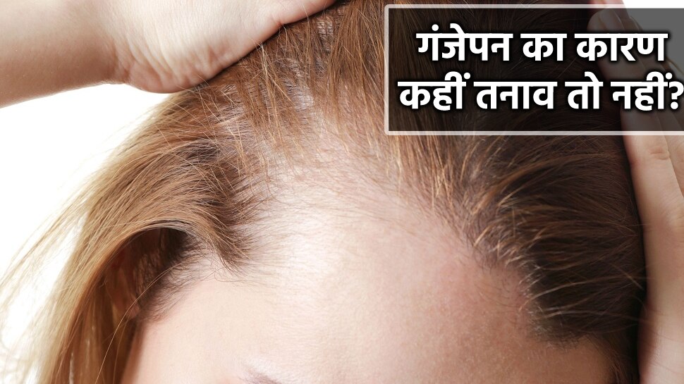 Update 73+ can stress cause hair fall in.eteachers