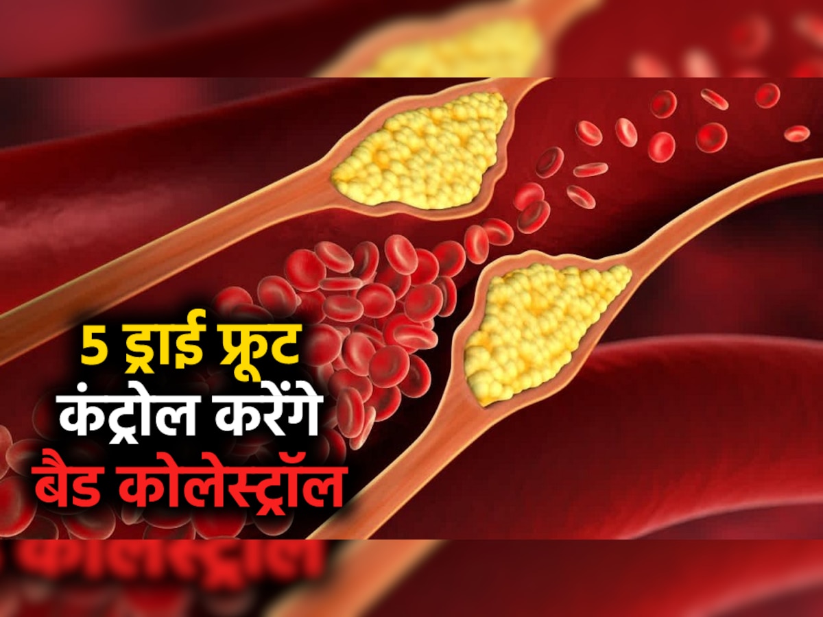 High Cholesterol: बिना दवाओं के कंट्रोल होगा हाई कोलेस्ट्रॉल, बस रोज पानी में भिगोकर खाएं ये 5 ड्राई फ्रूट