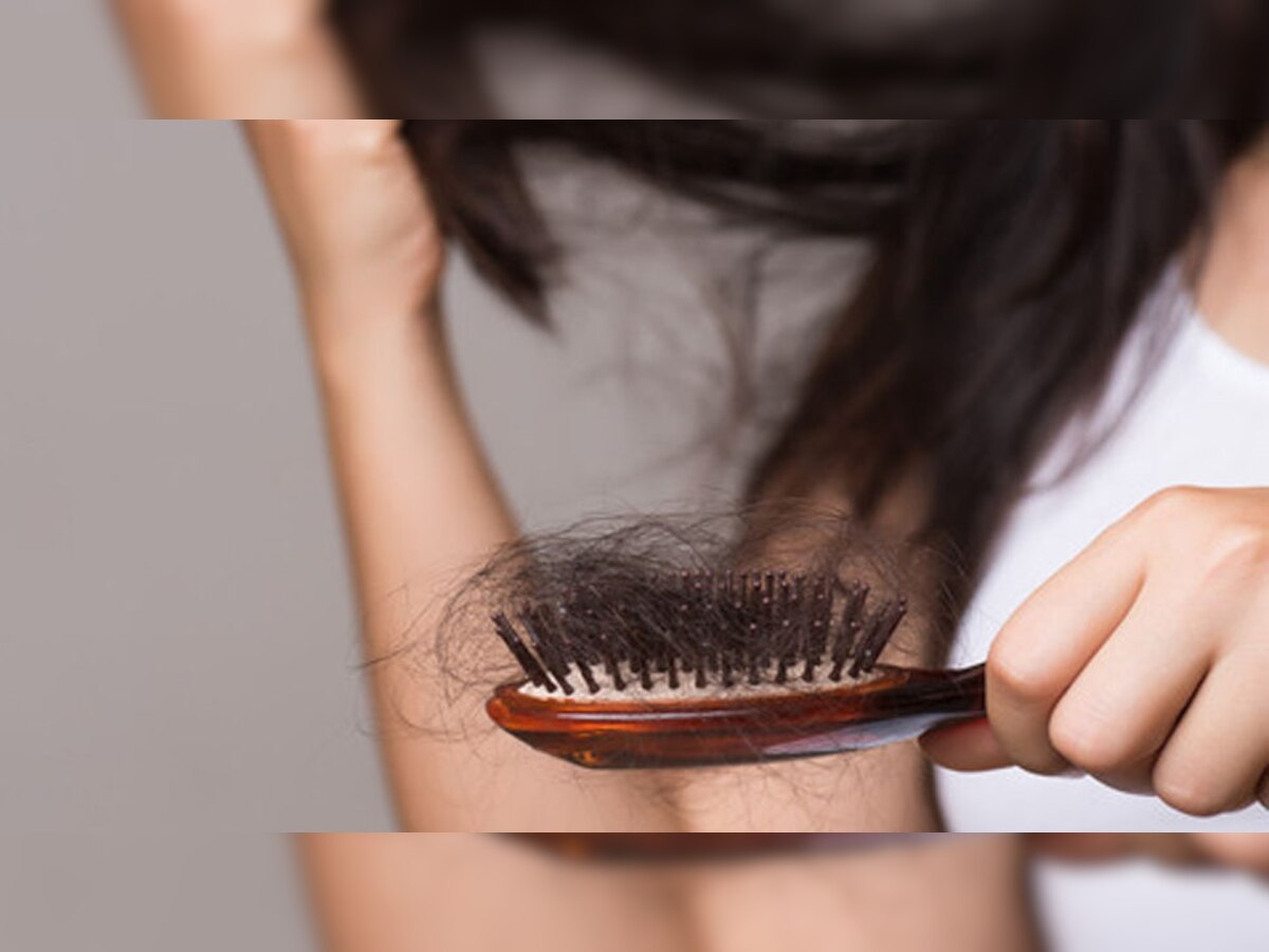 Hair Loss: क्या तेल लगाने से होता है हेयर लॉस? एक्सपर्ट्स ने बताई वजह