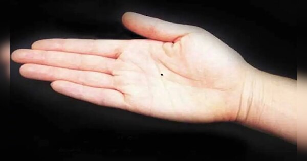 Mole on Hand: करोड़पति बनाता है हथेली की इस जगह पर बना तिल! जल्‍दी से