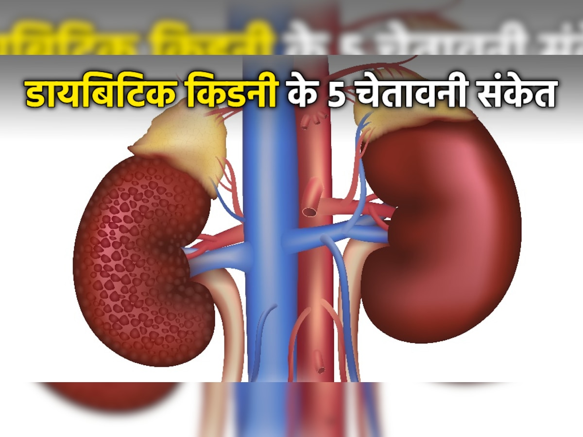 Diabetic Kidney: शरीर में ये 5 संकेत करते हैं गंभीर बीमारी की ओर इशारा, जानें कैसे रखें किडनी का ख्याल