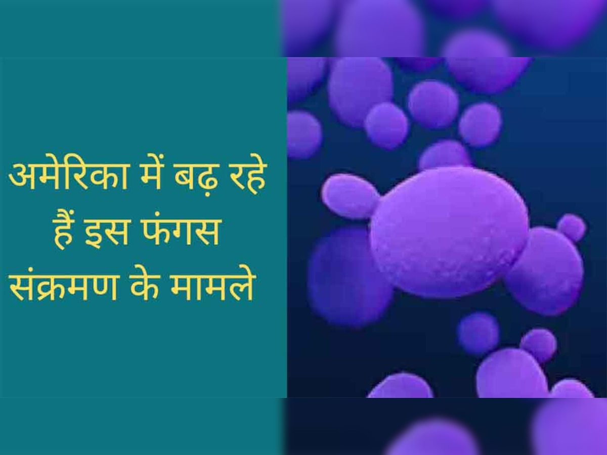 ये कौन सी नई बीमारी बन गई है US के लिए चिंता का विषय? क्या है इससे बचने के उपाय