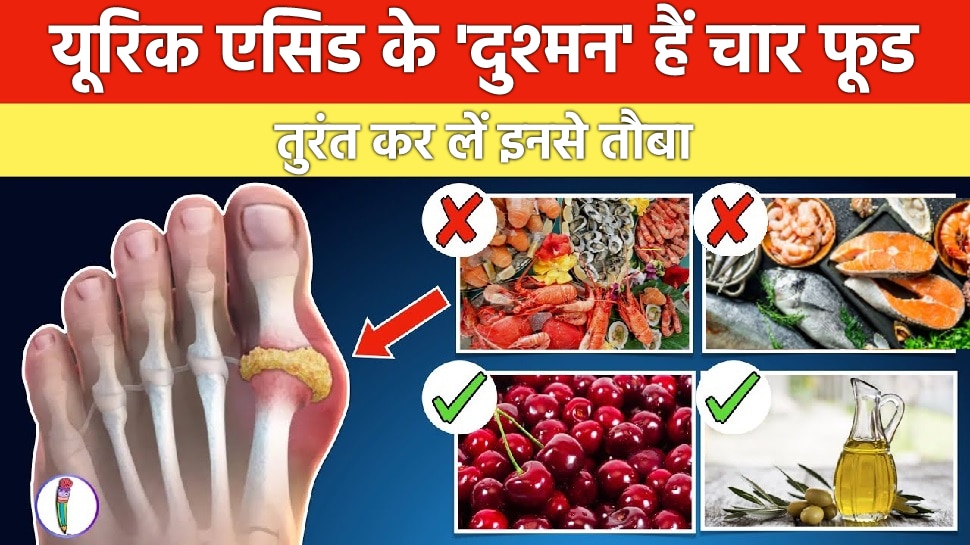 High uric acid level These four foods are enemies of uric acid avoid
