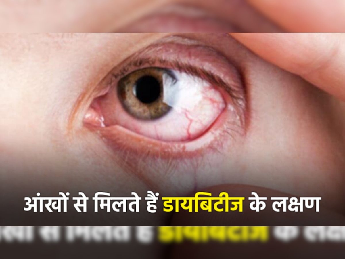 Diabetes Symptoms In Eyes: आंखों में ये 7 बदलाव देते हैं डायबिटीज के संकेत, ध्यान नहीं दिया को शुगर लेवल होगा बेकाबू