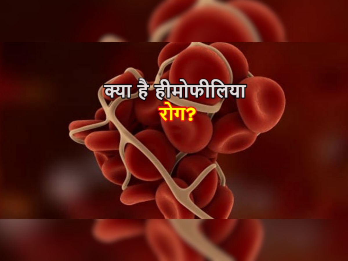 World Hemophilia Day: क्या जेनेटिक डिसऑर्डर की तरह होती है हीमोफीलिया की बीमारी? जानें इससे जुड़ी सभी जरूरी बातें 